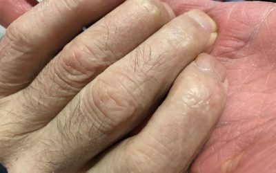 OS DEDOS DA MEMORIA en Versos e Aloumiños